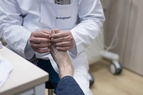 Juanete (hallux valgus): cuándo basta con tratamiento conservador y cuándo se opera