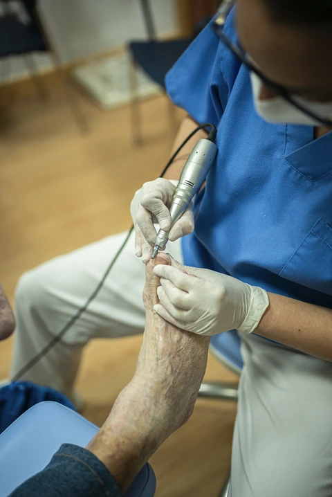 Uña encarnada (onicocriptosis): causas, tratamiento y prevención